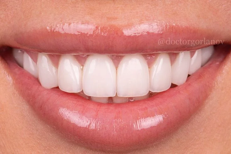 Estética Dental & Diseño de Sonrisa